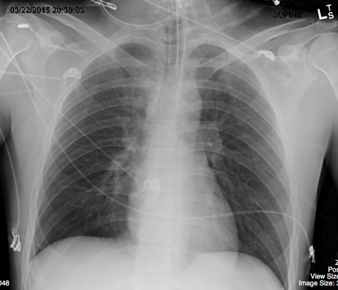 Tubes And Catheters Undergraduate Diagnostic Imaging Fundamentals