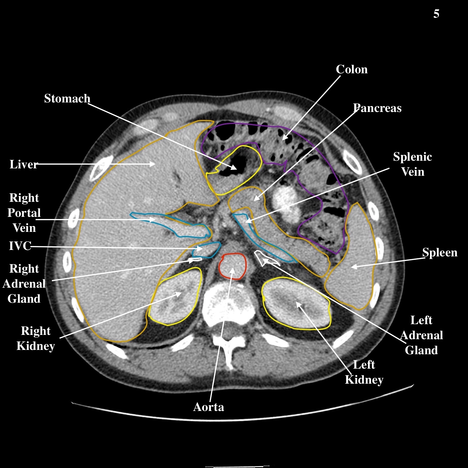 Abdomen Undergraduate Diagnostic Imaging Fundamentals