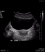 Pelvis Undergraduate Diagnostic Imaging Fundamentals