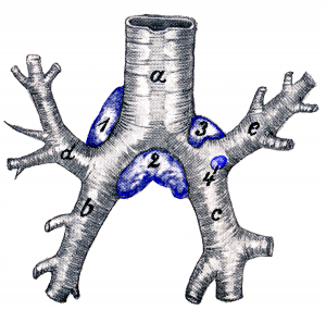 Drawing of the bronchi with associated lymph nodes and lymphatic vessels.
