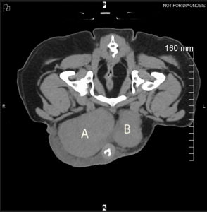 Transverse CT slice of a dog's caudal abdomen showing markedly enlarged superficial inguinal lymph nodes.