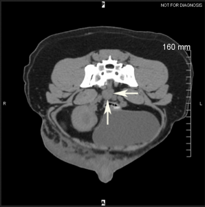 Transverse CT slice in pelvic region of a dog showing an enlarged sacral lymph node.