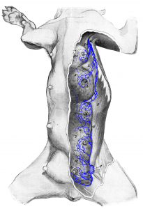 Drawing of the mammary glands with associated lymph nodes and lymphatic vessels.