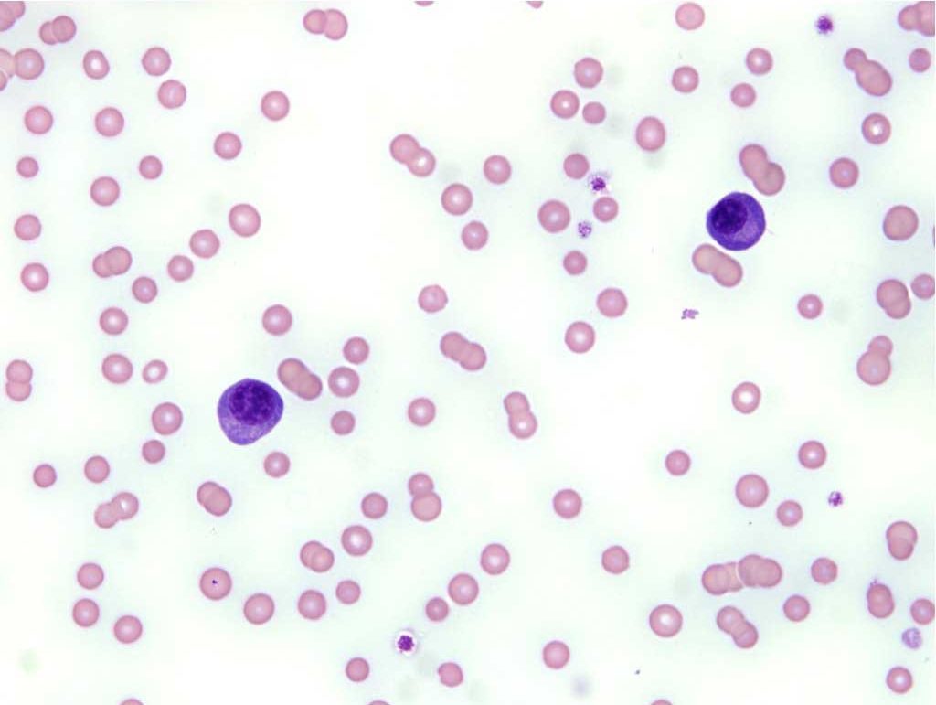 Figure 2.11 Plasma cells in the peripheral blood of a cat. This is an unusual finding that could relate to antigenic stimulation or a neoplastic process. Wright-Giemsa stain.