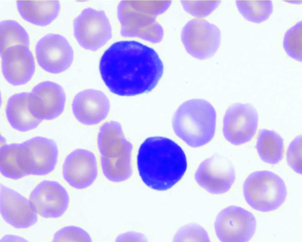 Figure 2.13 Reactive lymphocytes in a young dog, possibly post-vaccination. Wright-Giemsa stain.