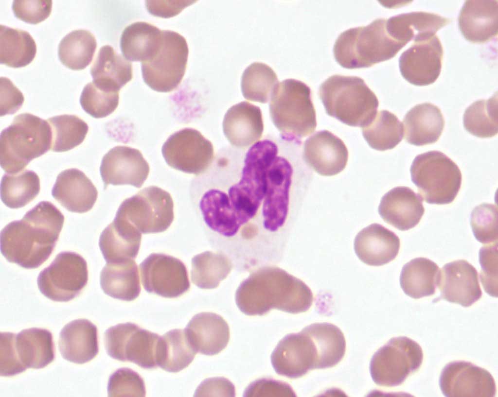 Figure 2.6 Chédiak-Higashi syndrome in a cat. Note the eosinophilic inclusion in the neutrophil cytoplasm. This represents abnormal lysosomal granule formation leading to impaired neutrophil function. Wright-Giemsa stain.