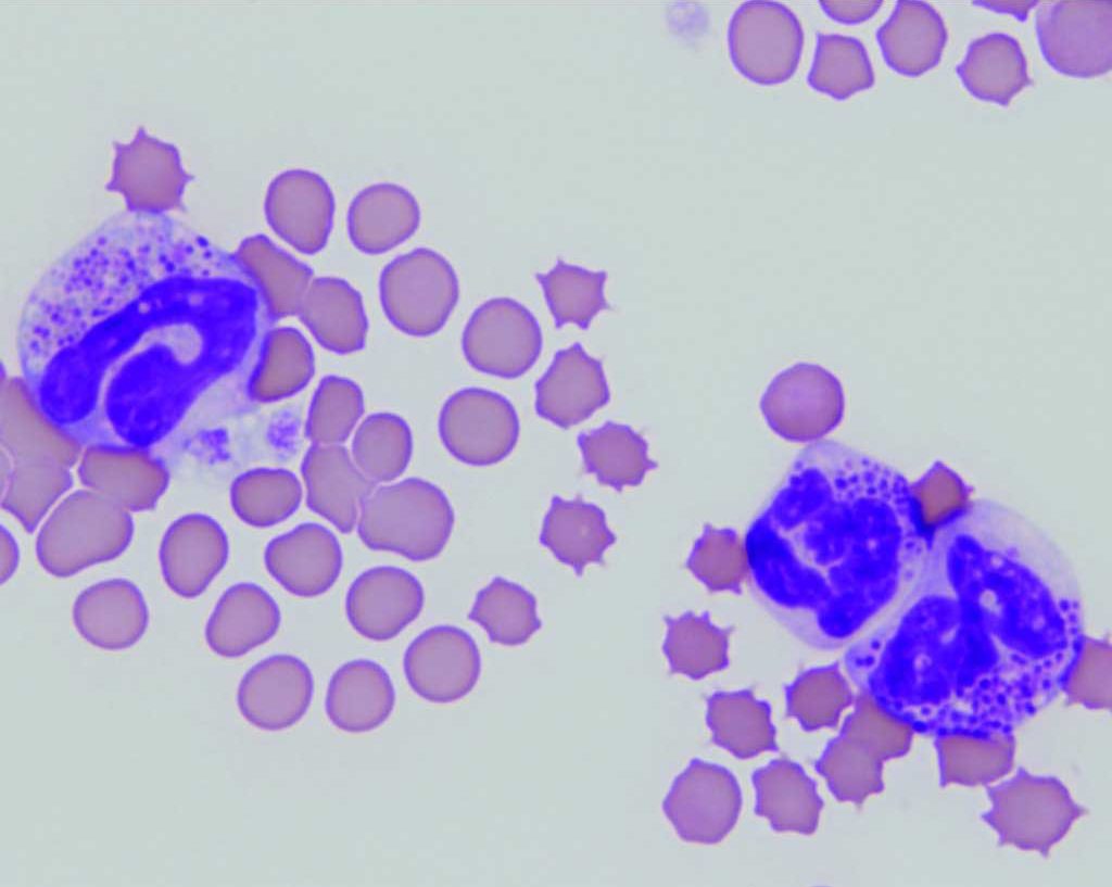 Figure 3.10 Blood film from a cat with basophilic leukemia, a rare acute myeloid neoplasm. The lobulated nucleus differentiates these cells from mast cells and large granular lymphocytes. Note: normal feline basophil granules do not stain as prominently as pictured here (see Chapter 2: Fig. 2.9 for normal feline basophils). Wright-Giemsa stain.