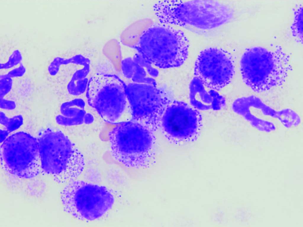 Figure 3.12 Blood film from a dog (not a cat, as in case 1, Micky) with mastocytemia due to neoplasia. These cells may be concentrated at the feathered edge of the smear - a reminder to always scan the entire smear before going to higher magnification. Wright-Giemsa stain.