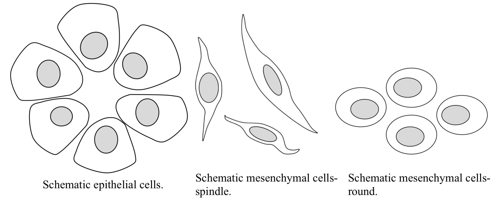 Figure 5.11 Line drawing of epithelial cells and mesenchymal cells. Mesenchymal cells may be spindle shaped or round.