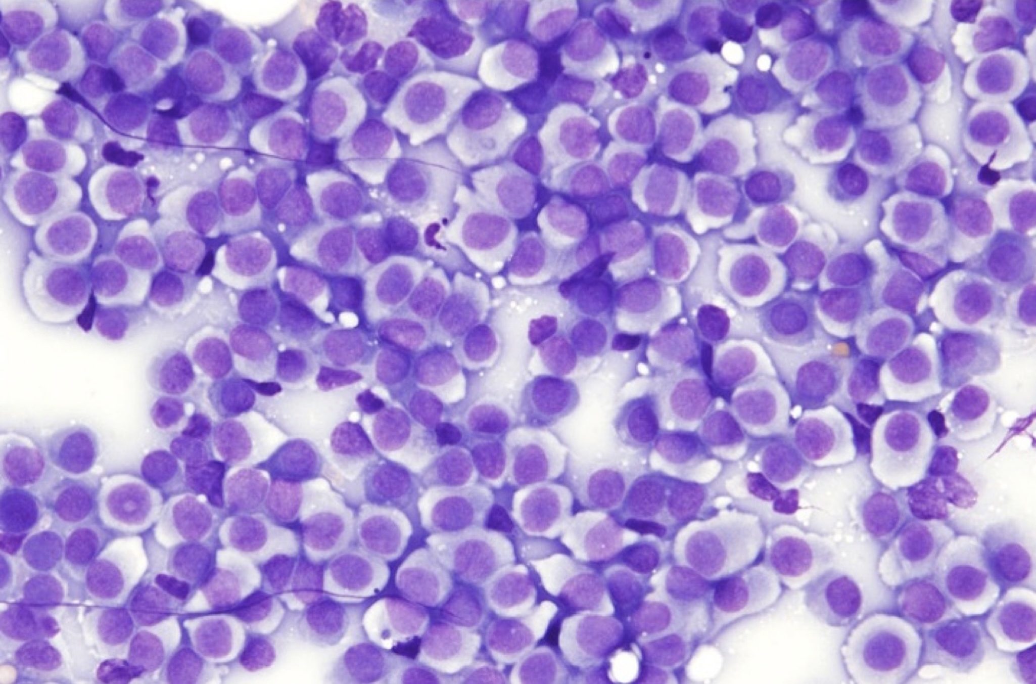 Figure 5.20 Histiocytes from a fine needle sample of a histiocytoma. Note uniform appearance and pale cytoplasm. (Wright-Giemsa; HP oil.) (Image courtesy of Dr. Angelica Galezowski.)