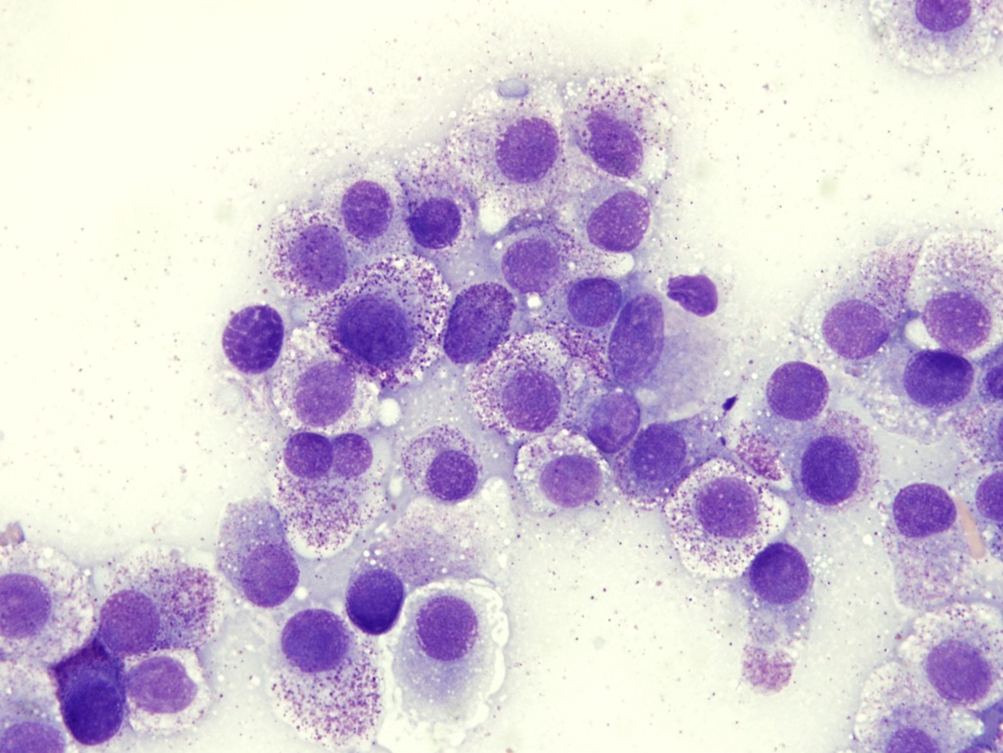 Figure 5.21 Poorly granulated mast cells from a fine needle sample of a mast cell tumor. There is also a binucleate mast cell. (Wright-Giemsa; HP oil.)