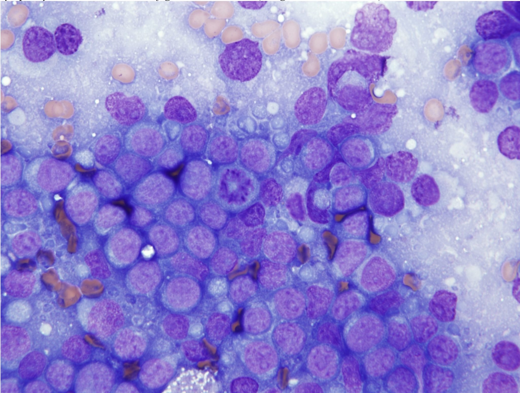 Figure 5.22 Neoplastic lymphocytes from a fine needle sample of an enlarged peripheral lymph node with lymphosarcoma. Note homogeneity of the lymphocyte population. Most cells are large lymphocytes. There is a mitotic figure in the centre. (Wright-Giemsa; HP oil.)