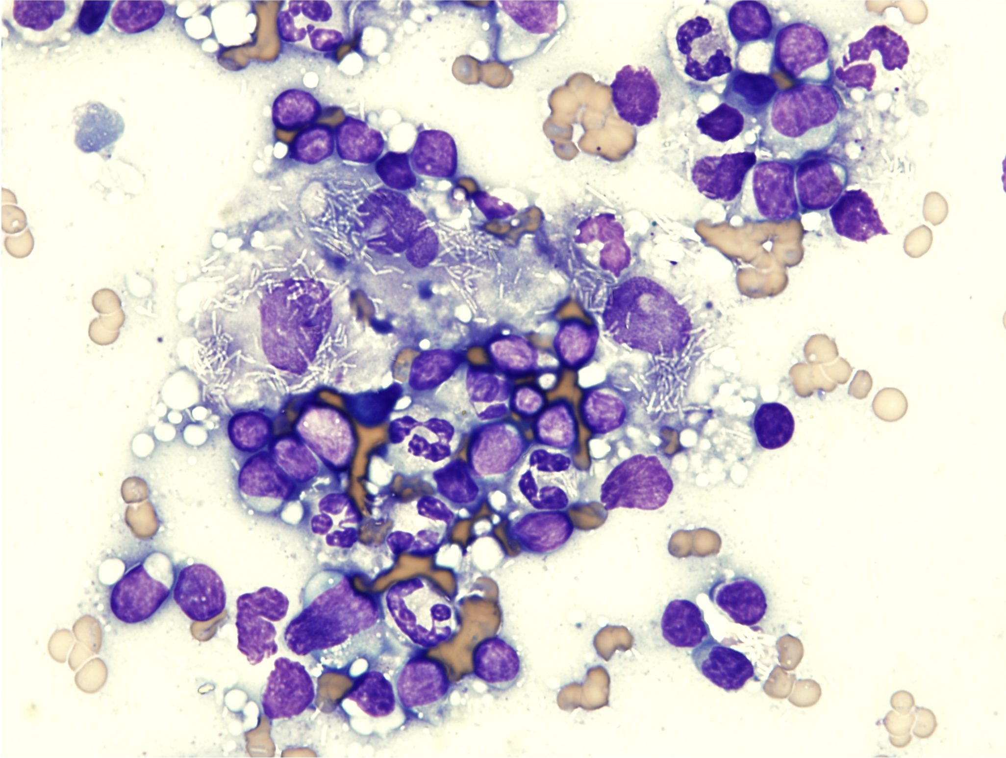 Figure 5.28 Macrophage-rich inflammation in a lymph node with mycobacteriosis. The clear, linear structures within the macrophages are non-staining mycobacteria. (Wright-Giemsa; HP oil.)