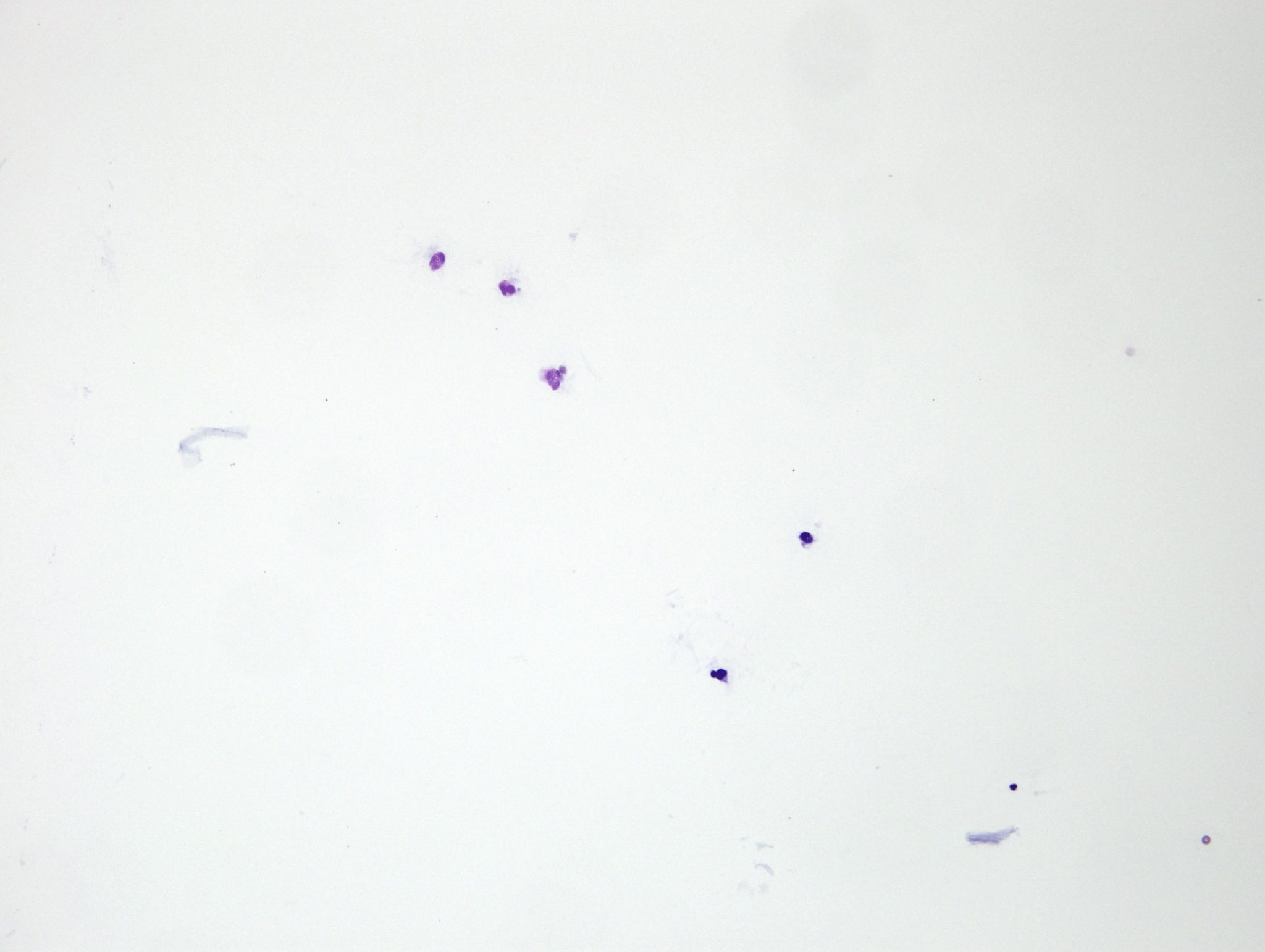 Figure 5.31 Direct smear of a transudate. Note low cellularity. The clear background is typical of a low protein concentration. (Wright-Giemsa; LP.)