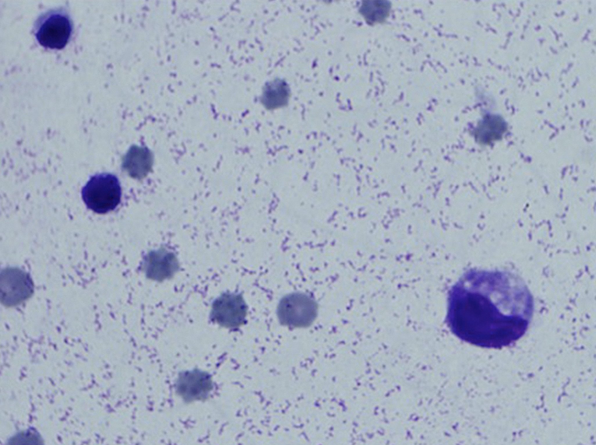 Figure 5.38 Abdominal fluid from a cat with feline infectious peritonitis. Note stippled background due to high protein content of the fluid. (Wright-Giemsa; HP oil.)