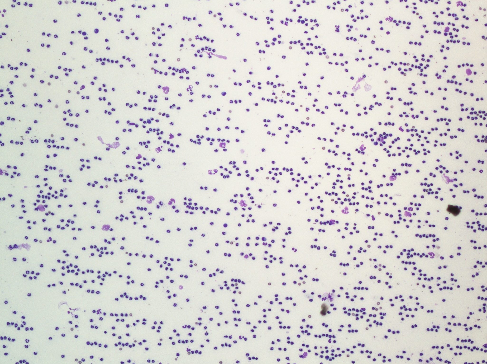 Figure 5.46 Synovial fluid- immune-mediated disease. Note numerous nondegenerate neutrophils. (Wright-Giemsa; LP.)