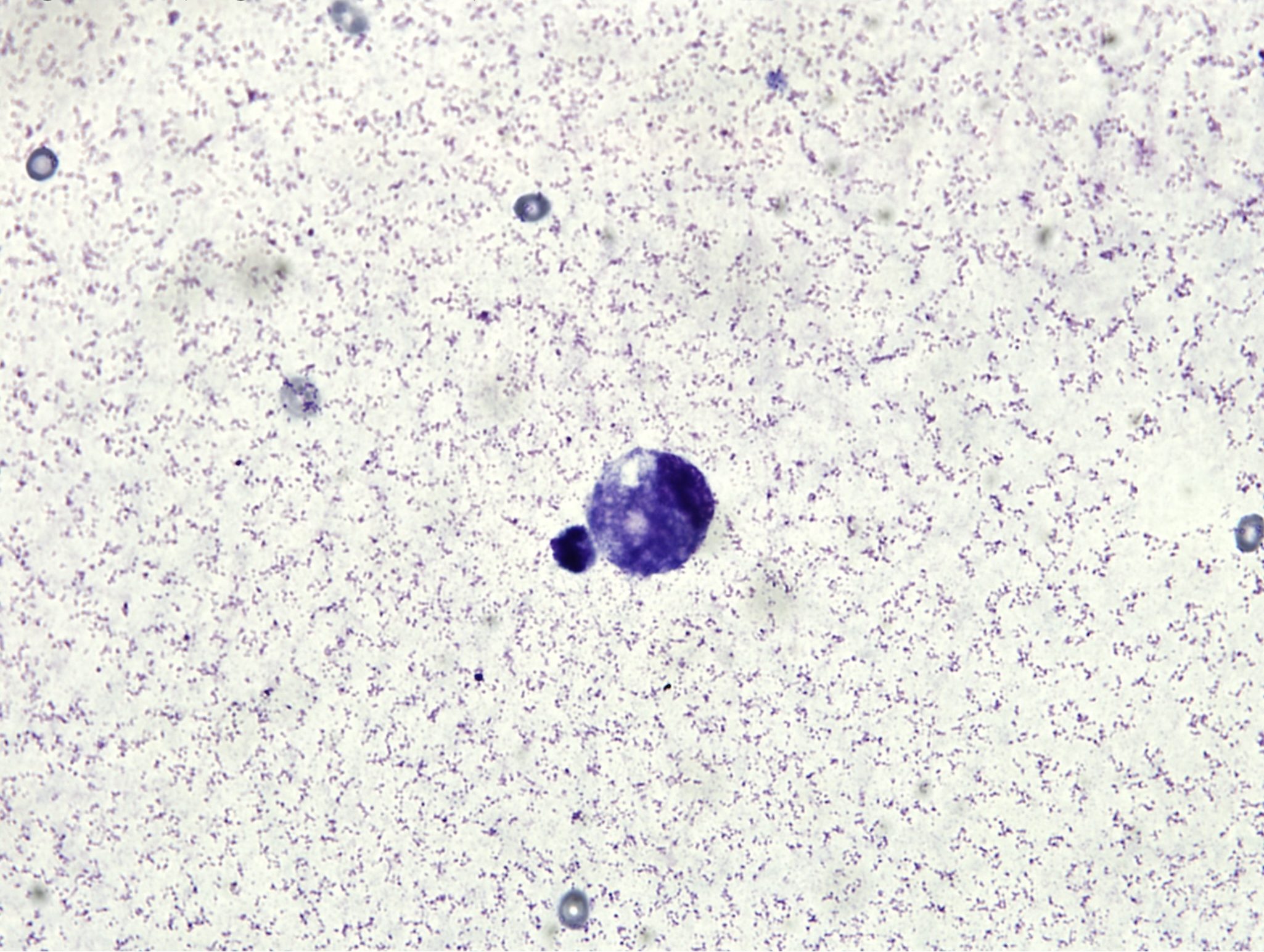 Figure 5.47a Case 1: Abdominal fluid from a cat. Please see text for description and interpretation. (Wright-Giemsa; HP oil.)