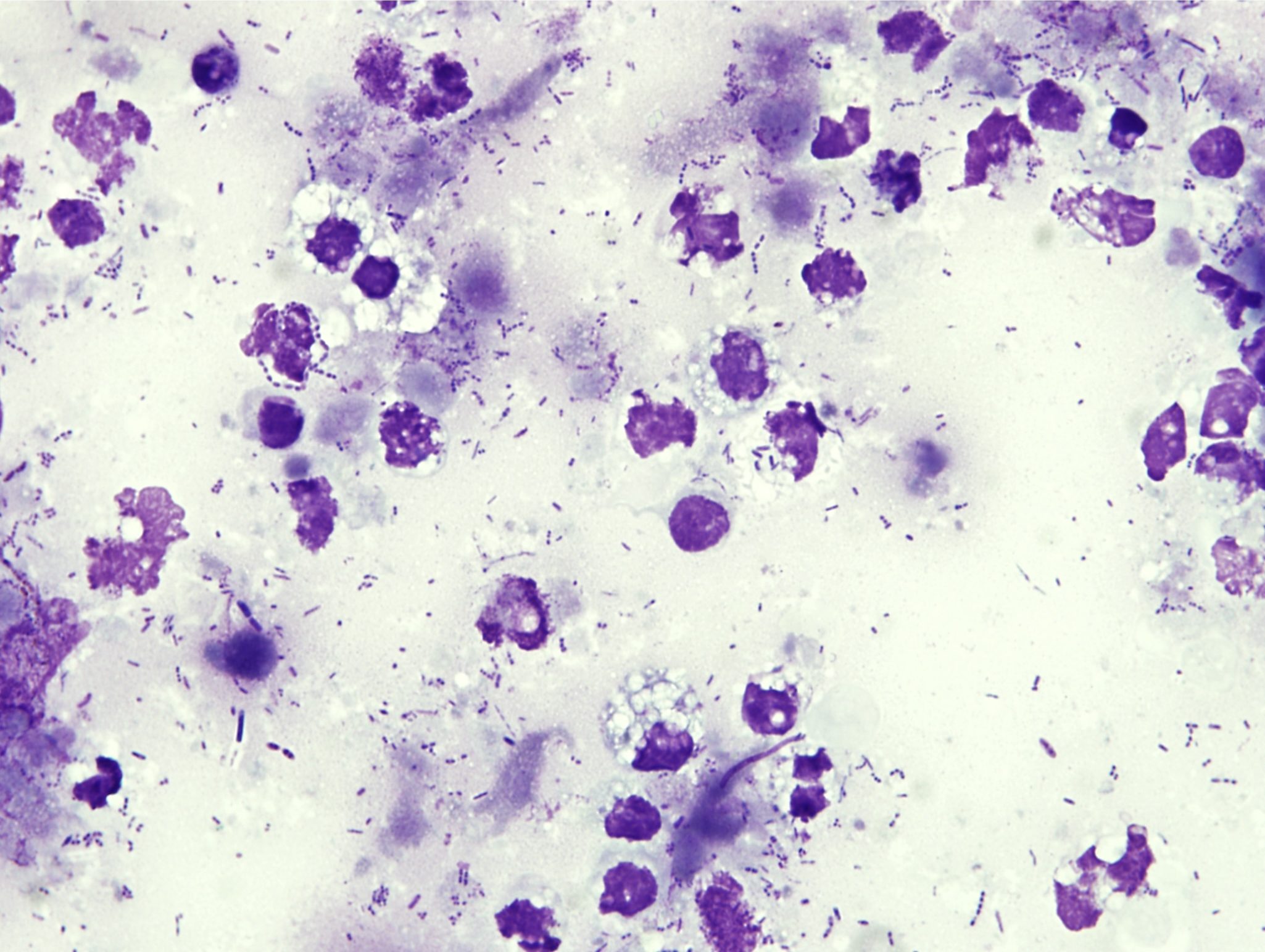 Figure 5.48 Case 2: Abdominal fluid from a dog. Please see text for description and interpretation. (Wright-Giemsa; HP oil.)