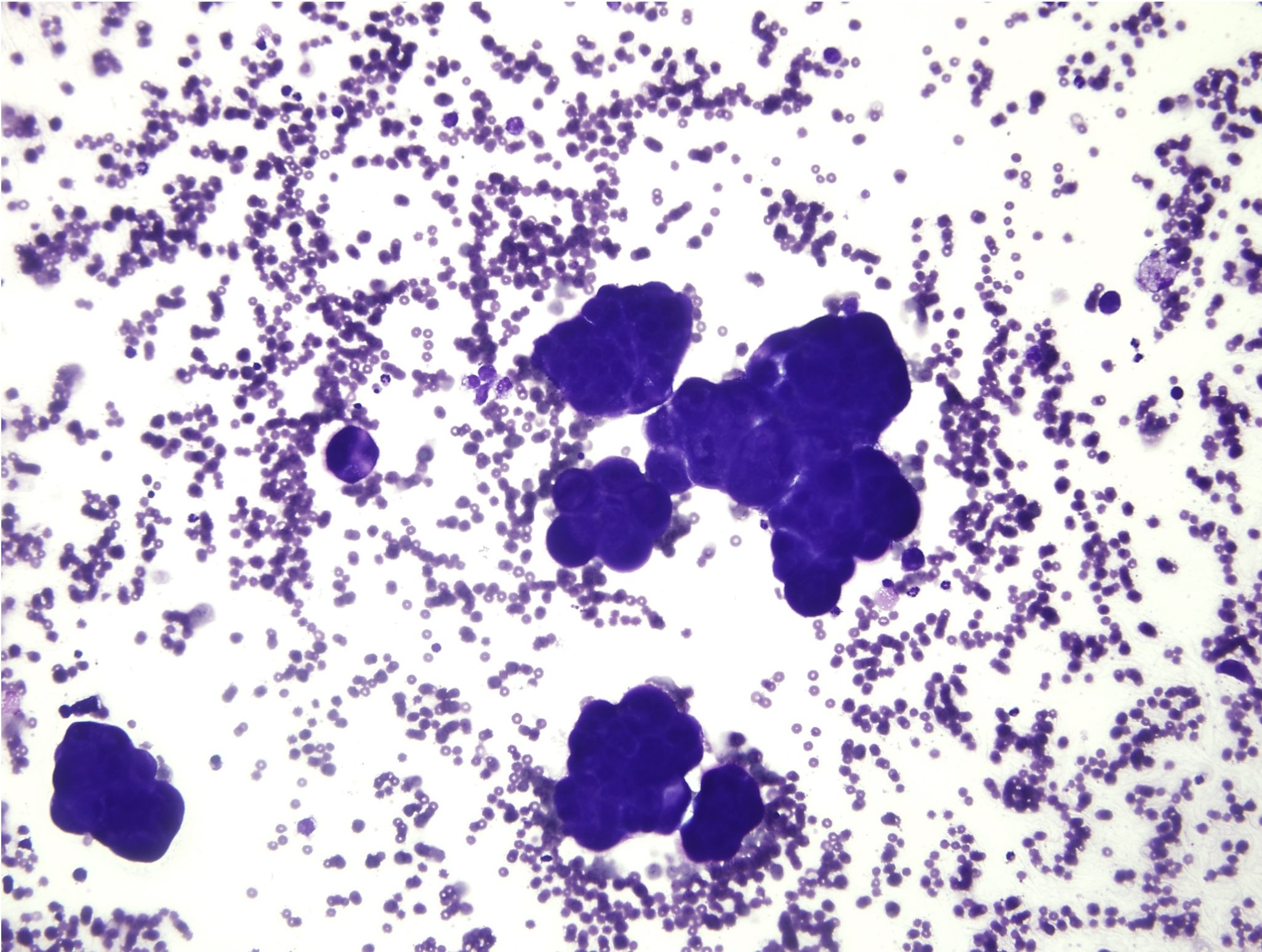 Figure 5.49a Case 3: Abdominal fluid from a dog. Please see text for description and interpretation. (Wright-Giemsa; LP.)