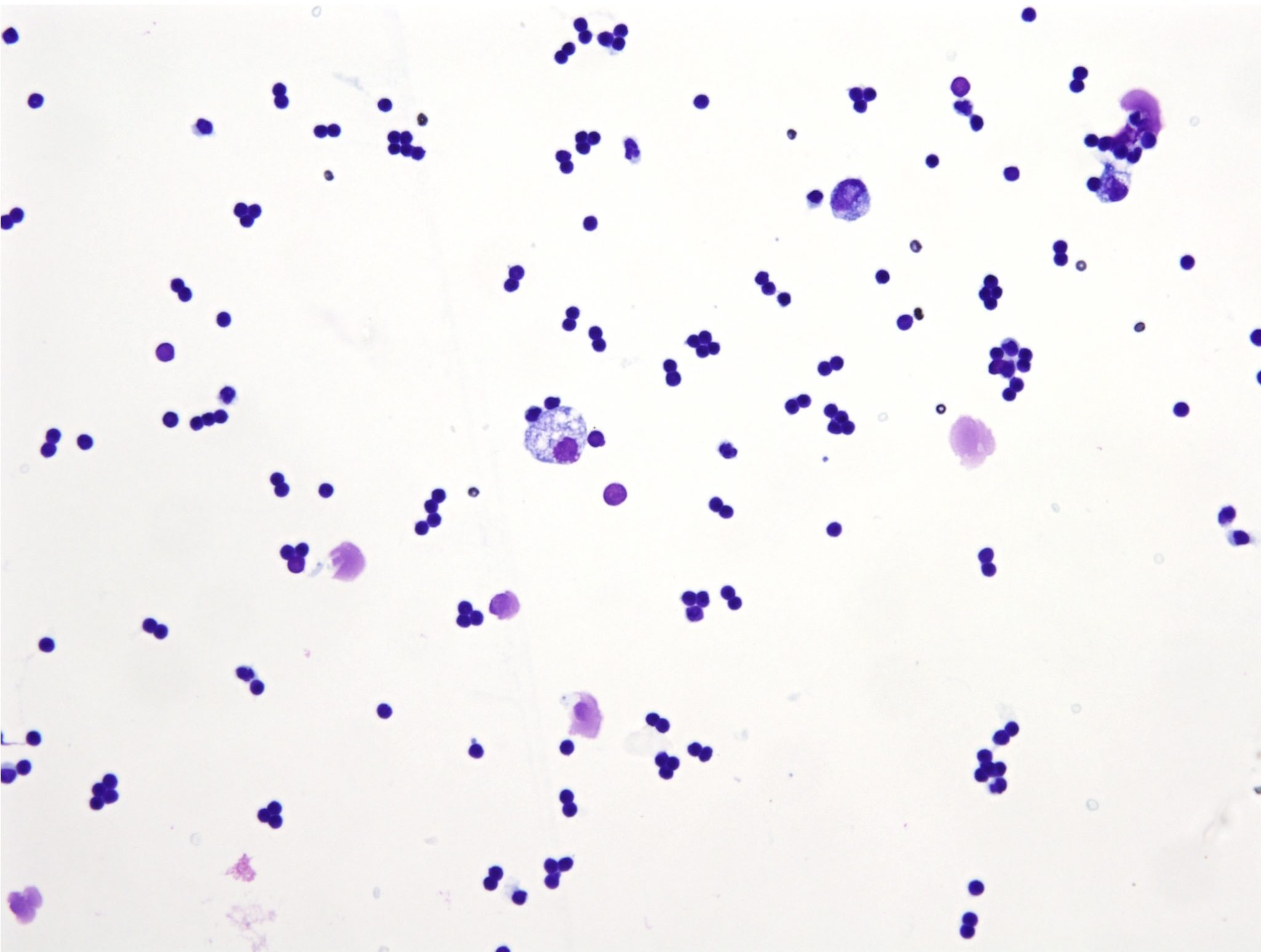 Figure 5.51a Case 5: Pleural fluid from a cat. Please see text for description and interpretation. (Wright-Giemsa; IP.)