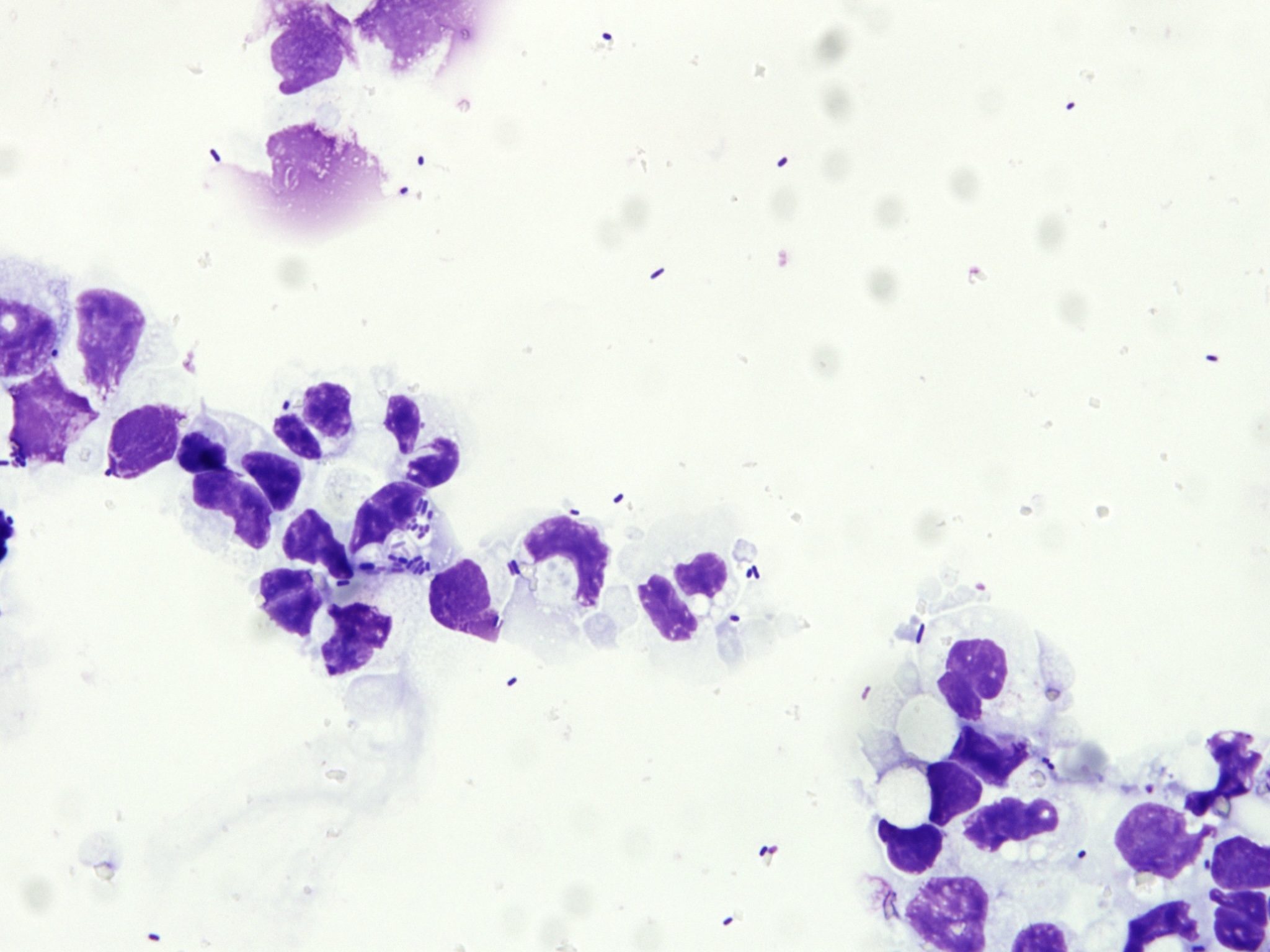 Figure 5.52 Case 6: Cerebrospinal fluid from a dog. Please see text for description and interpretation. (Wright-Giemsa; HP oil.)