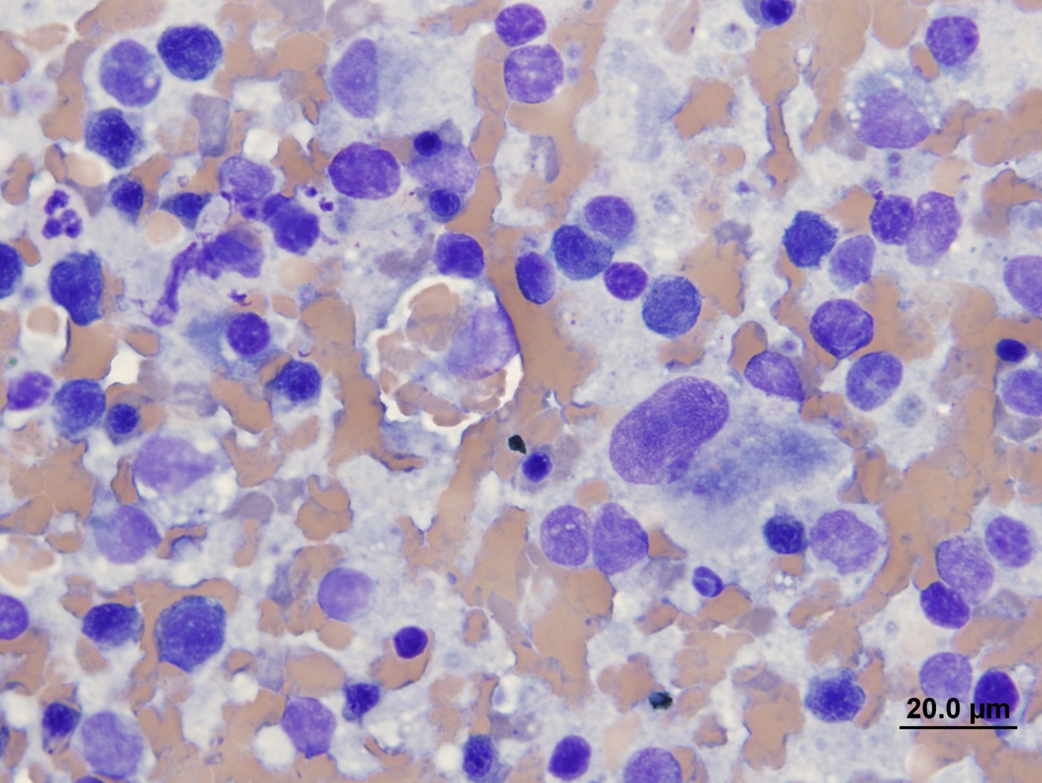 Figure 5.53a Case 7: Splenic aspirates from a dog. Please see text for description and interpretation. (Wright-Giemsa; HP oil.)