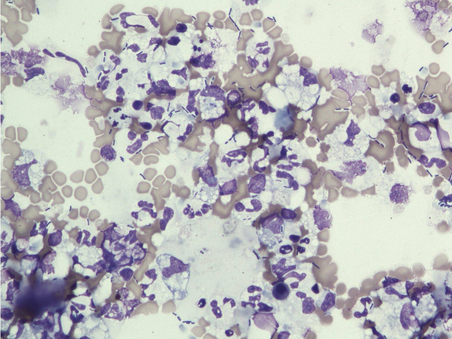 Figure 5.8 Intra and extracellular rod bacteria. This is an aspirate from a dog with bacterial prostatitis. (Wright-Giemsa; 1P.)