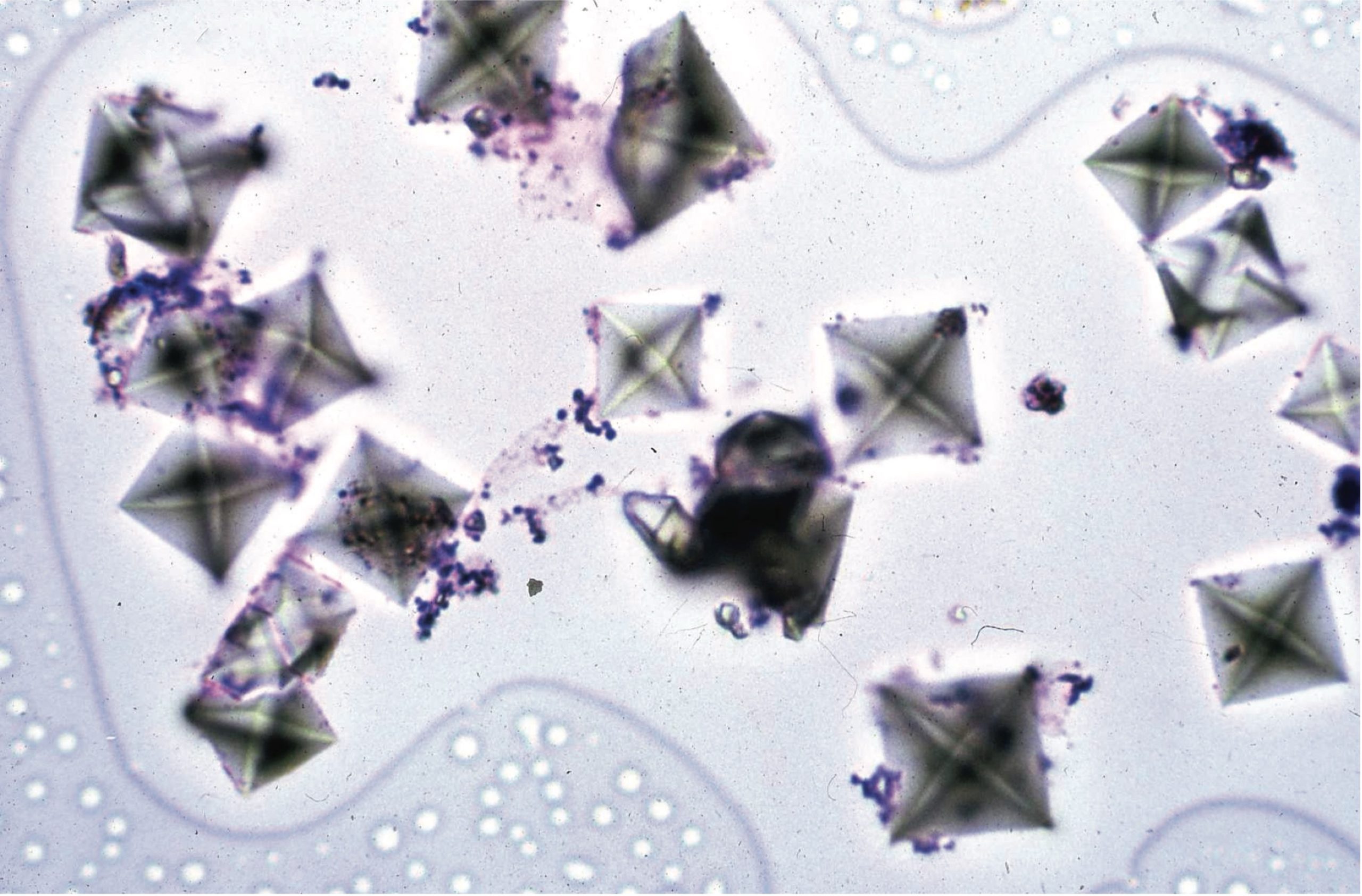 Figure 7.8 Urine sediment, sedistain. Calcium oxalate dihydrate crystals.