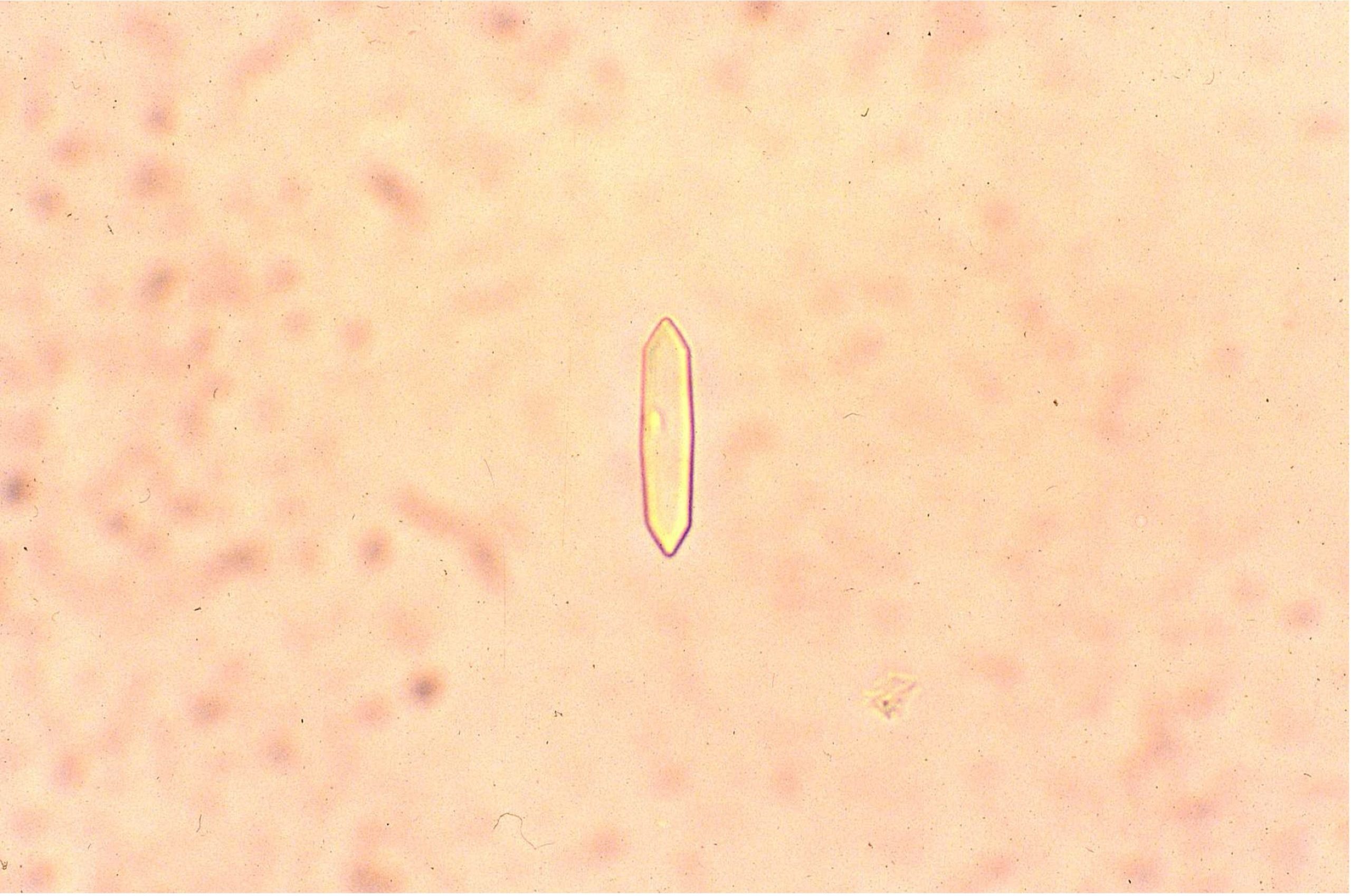 Figure 7.9 Urine sediment, unstained. Calcium oxalate monohydrate crystals.