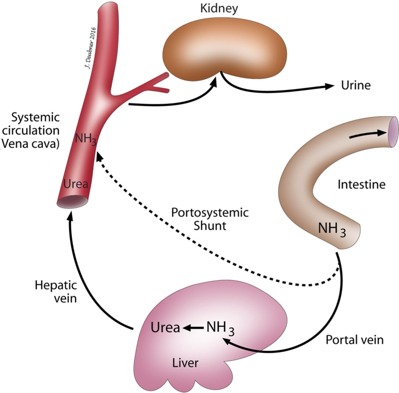 Figure 8.3 Large amounts of ammonia are formed through deamination of amino acids and by bacteria in the intestine. Ammonia is removed from the blood upon entering the urea cycle in hepatocytes. Urea is subsequently excreted by the kidneys. Portosystemic shunting of blood or significantly reduced functional hepatic mass results in impaired urea cycle activity (decreased serum urea) and increased serum ammonia levels.