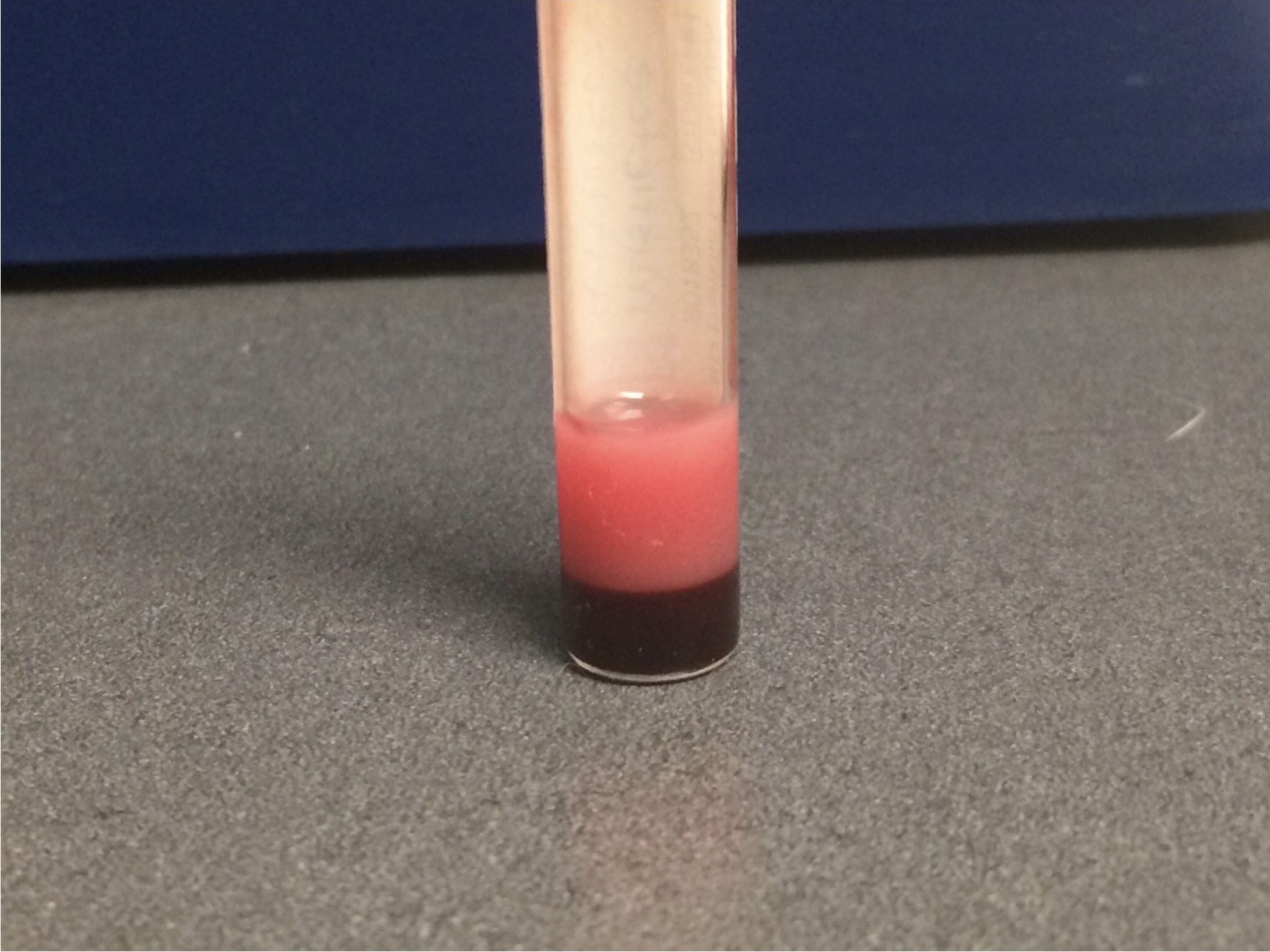 Figure 13.2 Lipemic serum. (Courtesy of Ms. Kim Christiansen, Prairie Diagnostic Services.)