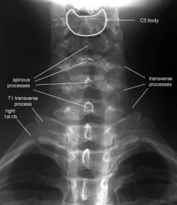 Head and Neck – Undergraduate Diagnostic Imaging Fundamentals