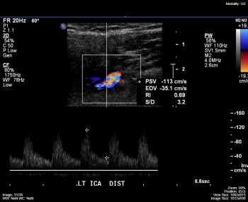 Ultrasound (US) – Undergraduate Diagnostic Imaging Fundamentals