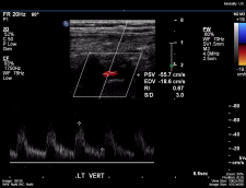 Ultrasound (US) – Undergraduate Diagnostic Imaging Fundamentals