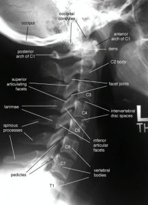 Head and Neck – Undergraduate Diagnostic Imaging Fundamentals