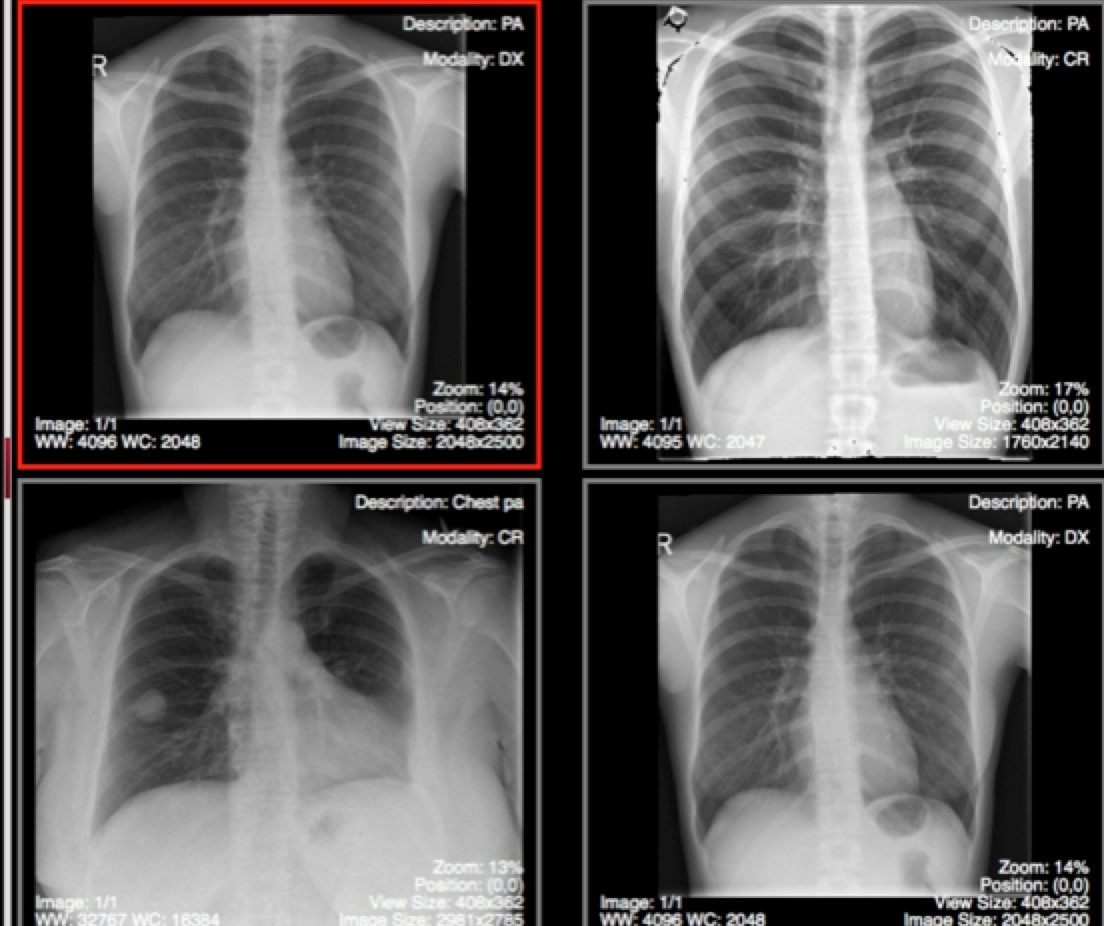 Online DICOM Image Viewer (ODIN): An Introduction and User Manual ...