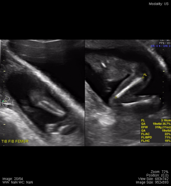 Pelvis – Undergraduate Diagnostic Imaging Fundamentals