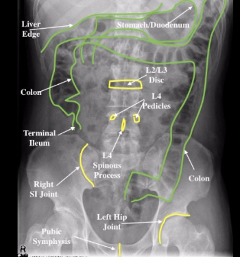 Abdomen – Undergraduate Diagnostic Imaging Fundamentals