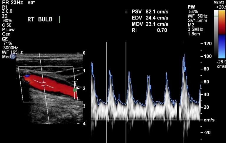 Ultrasound (US) – Undergraduate Diagnostic Imaging Fundamentals