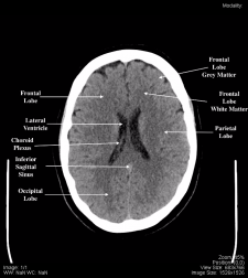 Head and Neck – Undergraduate Diagnostic Imaging Fundamentals