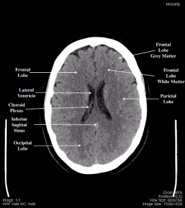 Head and Neck – Undergraduate Diagnostic Imaging Fundamentals