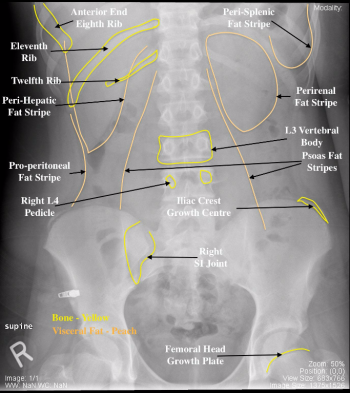 Pediatric – Undergraduate Diagnostic Imaging Fundamentals