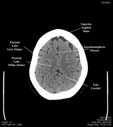 Head and Neck – Undergraduate Diagnostic Imaging Fundamentals