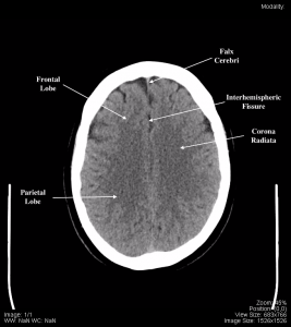 Head and Neck – Undergraduate Diagnostic Imaging Fundamentals