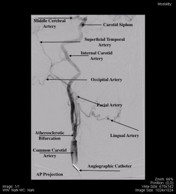 Head and Neck – Undergraduate Diagnostic Imaging Fundamentals