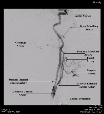 Head and Neck – Undergraduate Diagnostic Imaging Fundamentals