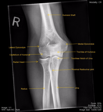 Musculoskeletal – Undergraduate Diagnostic Imaging Fundamentals