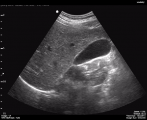 Ultrasound (US) – Undergraduate Diagnostic Imaging Fundamentals