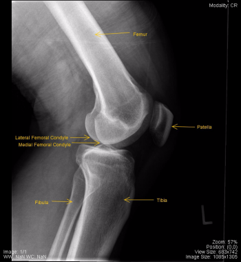 Musculoskeletal – Undergraduate Diagnostic Imaging Fundamentals