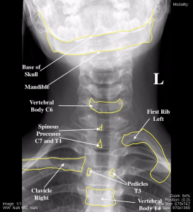 Head and Neck – Undergraduate Diagnostic Imaging Fundamentals